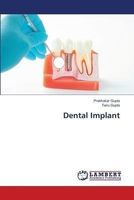 Dental Implant - Prabhakar Gupta