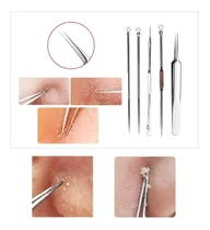 Comprar Set Removedor Extractor Espinillas Puntos Negros Acné