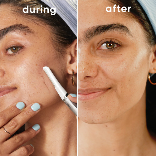 Ferramenta De Dermaplanagem Gillette Venus Com Recargas De 2