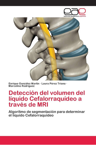 Libro: Detección Del Volumen Del Líquido Cefalorraquídeo A T