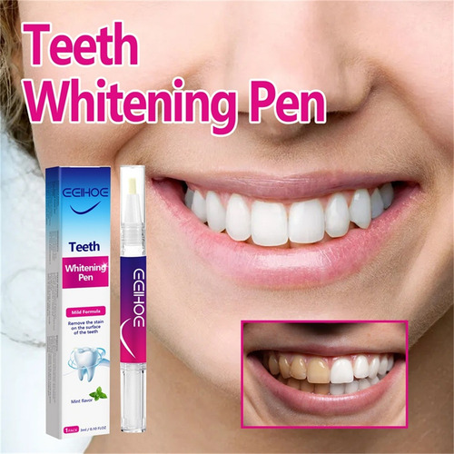 Blanqueamiento Dental E Lápiz Blanqueador Dental Blanqueamie