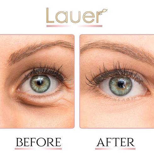 Lauer Under Eye Bags Treatment Patches | Eye Mask With Hyalu
