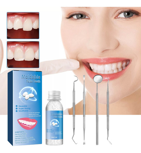 Kit De Reparo De Dentes Que Conserta O Dente Perdido E Quebr
