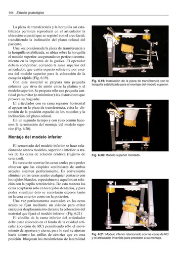 Ortodoncia Y Cirugia Ortognatica Gregoret | Envío gratis