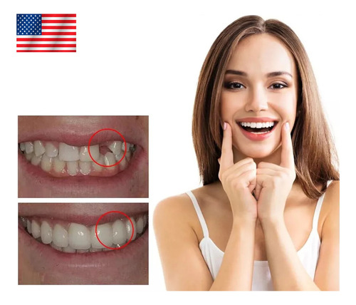 Diente Provisorio Relleno Postizo Dental