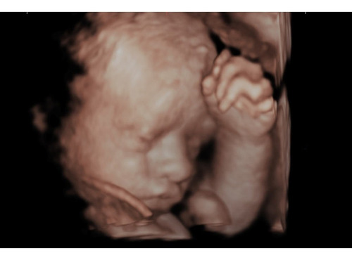 Imagen 4 de 5 de Ecografia 5d! Vas A Esperar 9 Meses Para Conocer A Tu Bebé?