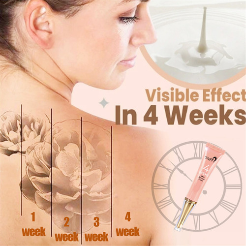 P Cuidado De La Piel C68 Tattoo Removal Cream Eliminación Pe