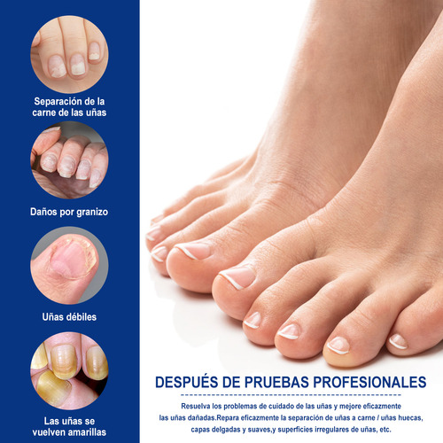 Para Eliminar Hongos En Uñas De Manos Y Piessolución, 30ml