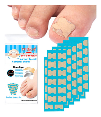 Tratamiento De Uñas De Los Pies Para Uñas Gruesas Dañadas, 1