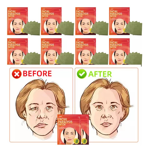 8 Masajes Efectivos Para Corregir La Parálisis Facial Con Pu