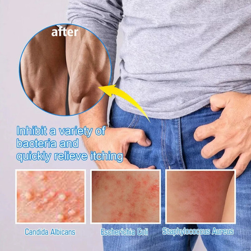 Crema Para La Picazón En Partes Íntimas Masculinas 3pcs