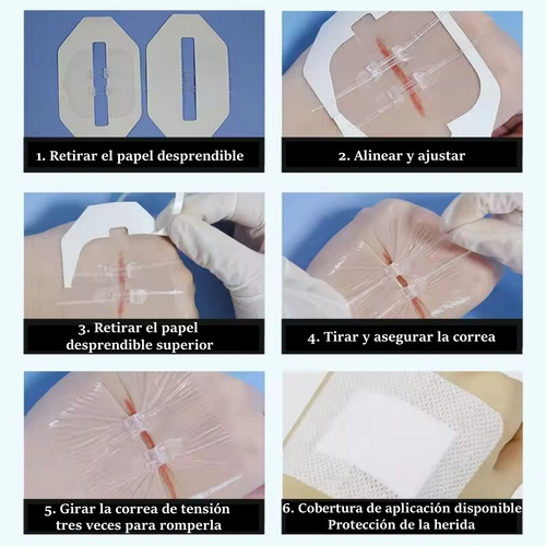 2 Tiras De Cierre Heridas De Emergencia Vendaje De Puntada