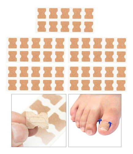 Xfw2 Toe Corrector Stickers Fixer Herramienta De 5 Hojas