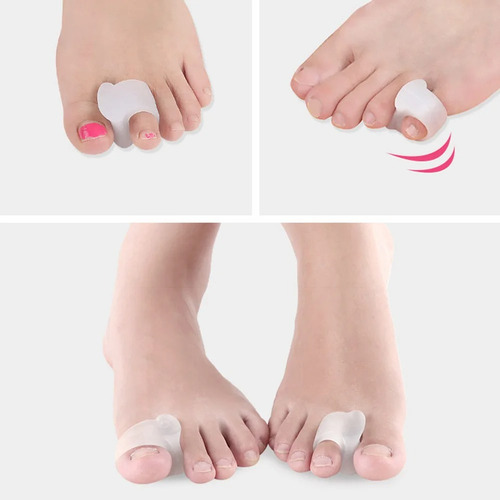 Corrector De Juanete Hallux Valgus Dedo Del Pie Separador