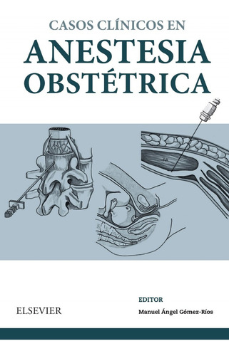 Casos Clínicos En Anestesia Obstètrica - Gómez-ríos, Manuel