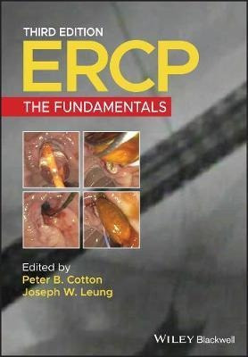 Ercp : The Fundamentals - Peter B. Cotton