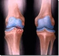 Cinta Fisioterapia Magnética Domiciliar