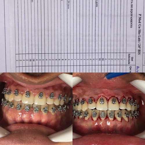 Imagem 4 de 5 de Reabilitação Oral E Harmonização Orofacial