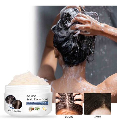 Shampoo De Enxofre Para Remover Piolhos, Aliviar A Coceira,
