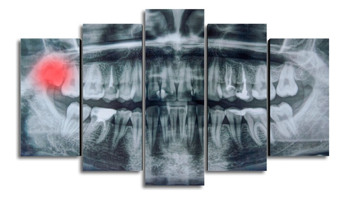 Cuadros Decorativos Dentista Odontólogo Ortodoncia 