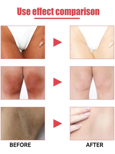 Esencia De Rosa, Blanqueadora De Las Partes Íntimas Femenina