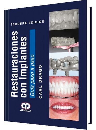 Restauraciones Con Implantes Tercera Edicion