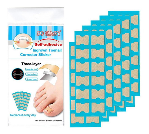 Tiras De Pegatinas De Corrección De Uñas Kit De 120 Hojas
