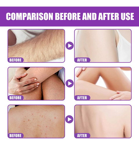 Nuevo R Gleam Exfoliante Exfoliante Exfoliante Exfoliante