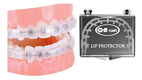 Protectores Labiales Para Brackets Y Ortodoncia: Cómodos Y P