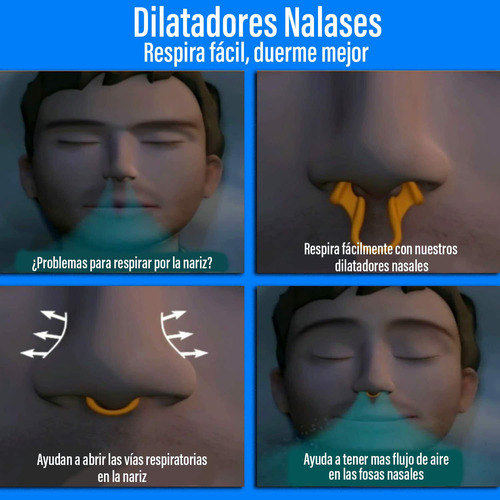 Dilatadores Nasales De Silicona (4) - Dilatador Nasal,