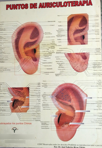 Gráfica Con Marco Puntos De Auriculoterapia