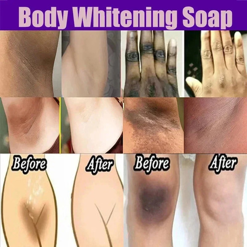 Jabón De Tocador Jabón Blanqueador Corporal Deep Clean Skin