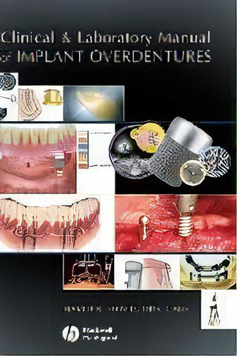 Clinical And Laboratory Manual Of Implant Overdentures, De Hamid Shafie. Editorial Iowa State University Press, Tapa Dura En Inglés