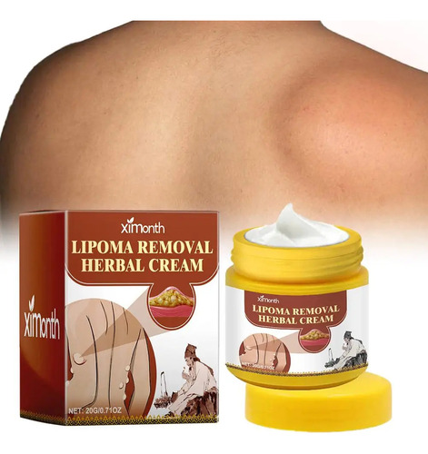 Crema Para Eliminar Bultos Subcutáneos Lipoma Cream, 20 G