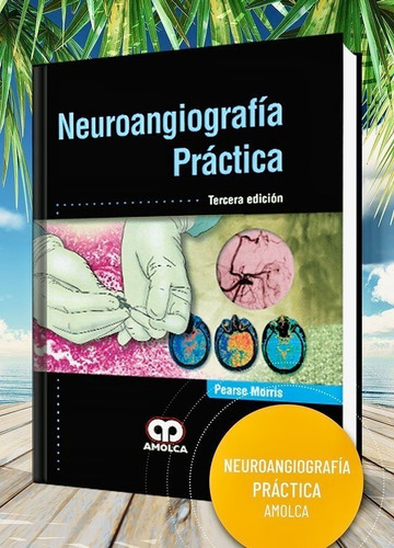 Neuroangiografía Práctica 3 Ed.