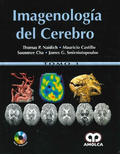 Libro Imagenología Del Cerebro - 2 Tomos De Mauricio Castill