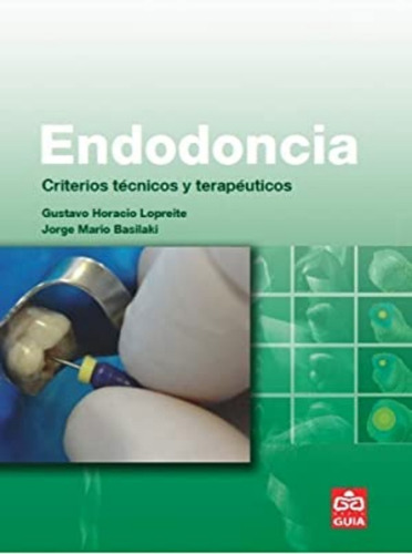 Endodoncia. Criterios Técnicos Y Terapéuticos. Lopreite. 