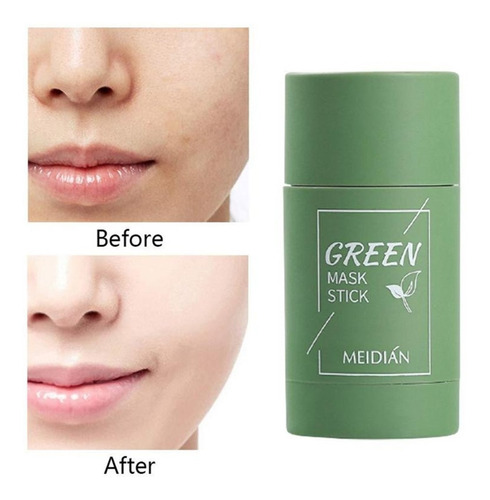 Imagen 4 de 9 de Green Mask Mascarilla Anti Acne Y Puntos Negros