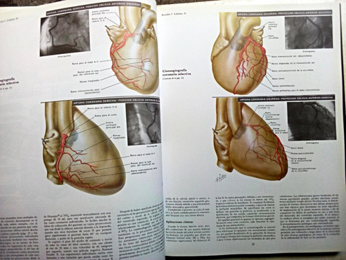 Colección Netter De Ilustraciones Médicas Tomo 5 Corazón