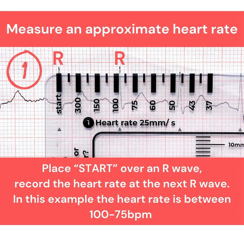 2 Reglas De Electrocardiograma De 7 Pasos Para Análisis Rápi