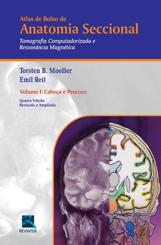 Atlas de Bolso de Anatomia Seccional - Tomografia Computadorizada e Ressonância Magnética - Volume I: Cabeça e Pescoço, de Moeller, Torsten B.. Editora Thieme Revinter Publicações Ltda, capa mole em português, 2015