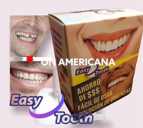 Kit Diente Provisorio Para Reemplazar Un Diente Easy Tooth