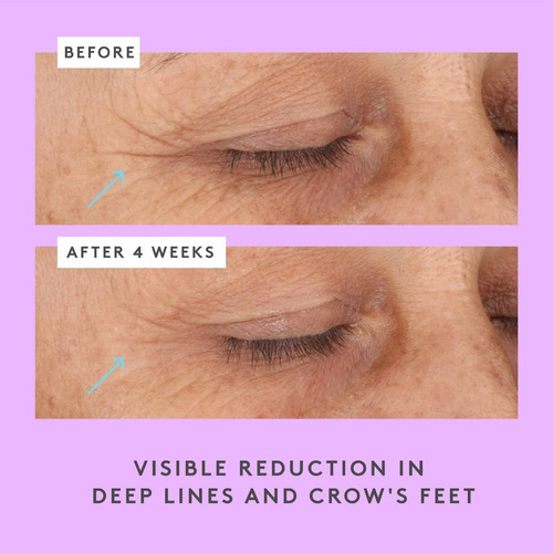 Creme de olhos Ceramighty Af com ceramidas — bebida em pó, tipo de pele de elefante, todos os tipos de pele