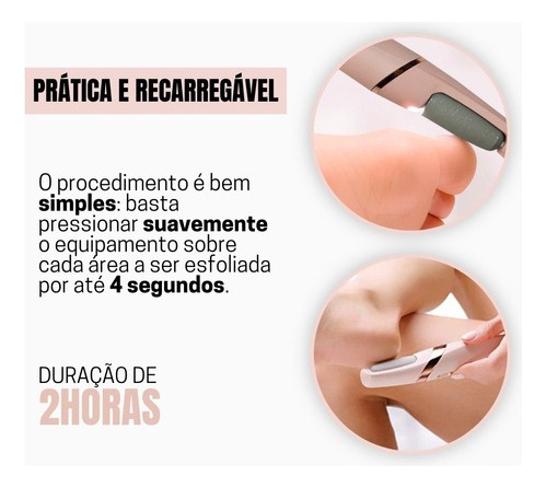 Aparelho Para Lixar Os Pés Removedor De Calos Rachaduras