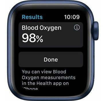 Imagen 4 de 4 de Apple Watch Series 6 Gps 40mm Blue Aluminium Case With Deep