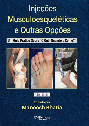 Livro: Injecoes Musculoesqueleticas E Outras Opcoes