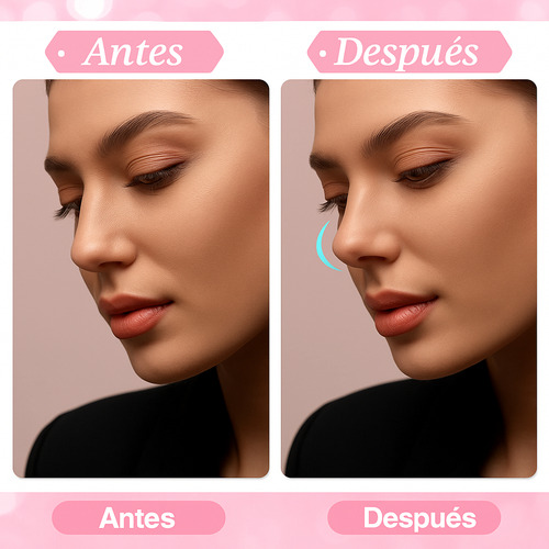 Corrector Nasal Para Respirar Mejor Y Respingar Tu Nariz Kit Negro Junior Small Medium