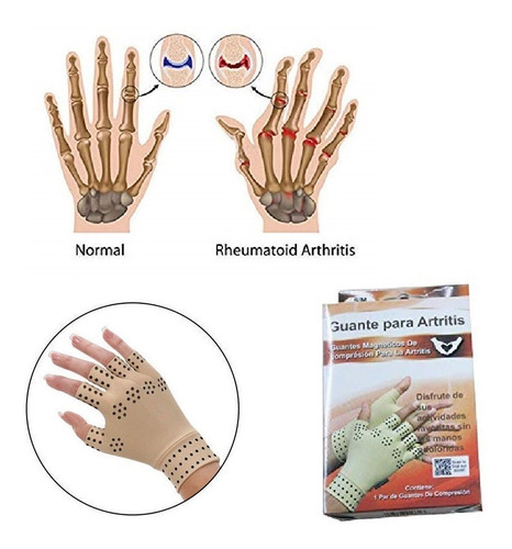 Guantes Para La Artritis/guantes De Compresión -imanes