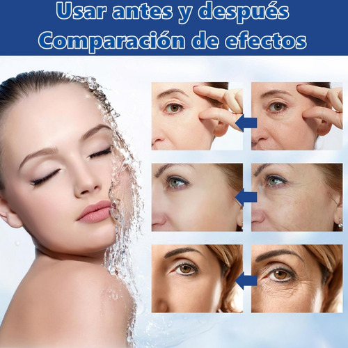 4pcs Mask, Pore Minimizing Elasticity Improvem