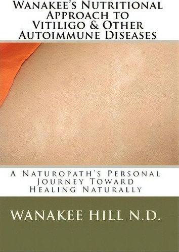 Wanakee' S Nutritional Approach To Vitiligo & Other Autoimmune Diseases, De Wanakee Hill N D. Editorial Createspace Independent Publishing Platform, Tapa Blanda En Inglés